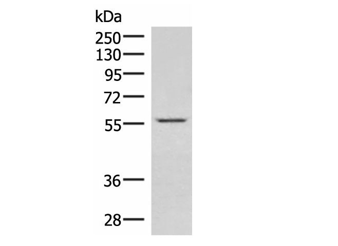 IPPK Polyclonal Antibody Reactivity Rat
