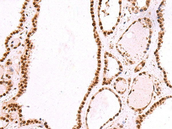 IRF2BP1 Polyclonal Antibody Reactivity Mouse