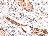 IRF2BP1 Polyclonal Antibody Reactivity Mouse