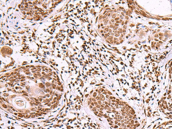IRX1 Polyclonal Antibody Reactivity Human