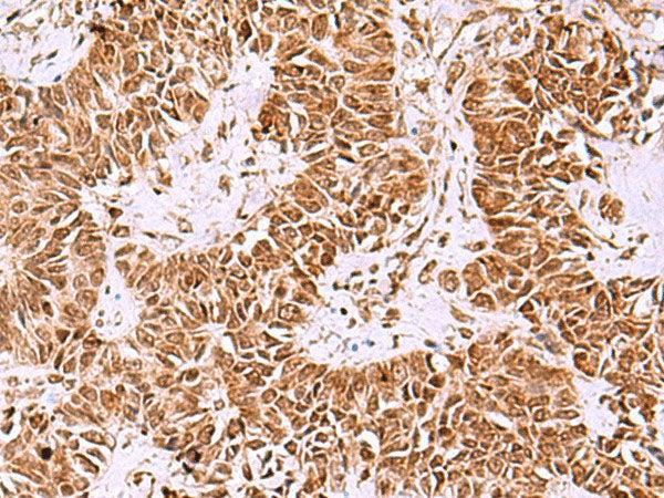 IRX1 Polyclonal Antibody Reactivity Human