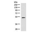 IRX1 Polyclonal Antibody Reactivity Human