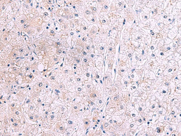 IRX2 Polyclonal Antibody Reactivity Human