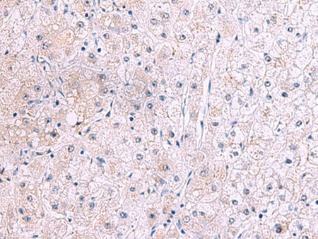 IRX2 Polyclonal Antibody Reactivity Human