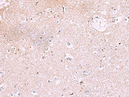 IRX2 Polyclonal Antibody Reactivity Human