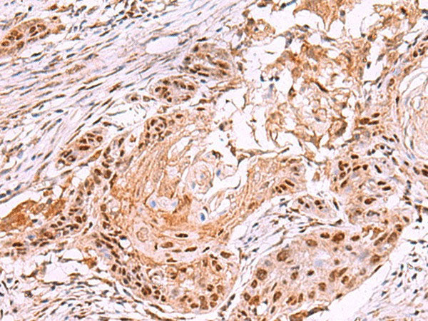 IRX4 Polyclonal Antibody Reactivity Mouse