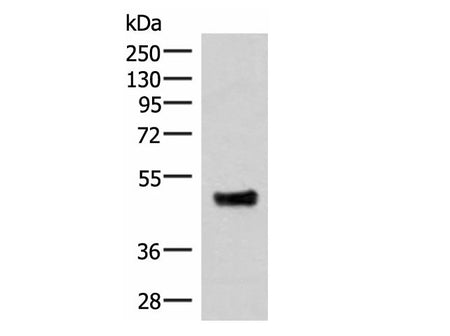 IRX5 Polyclonal Antibody