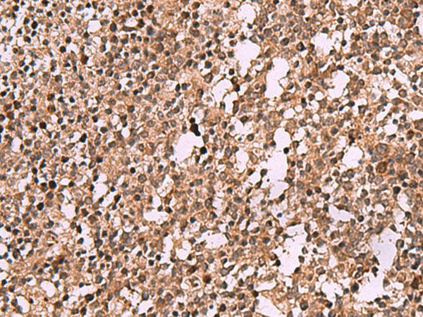 IST1 Polyclonal Antibody Reactivity Rat