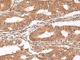 IST1 Polyclonal Antibody Reactivity Rat
