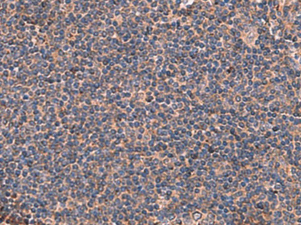ITGA11 Polyclonal Antibody Reactivity Human