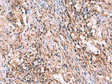ITIH4 Polyclonal Antibody Reactivity Human