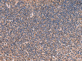 ITIH4 Polyclonal Antibody Reactivity Human