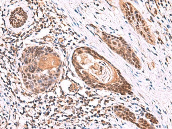 ITPR2 Polyclonal Antibody Reactivity Rat