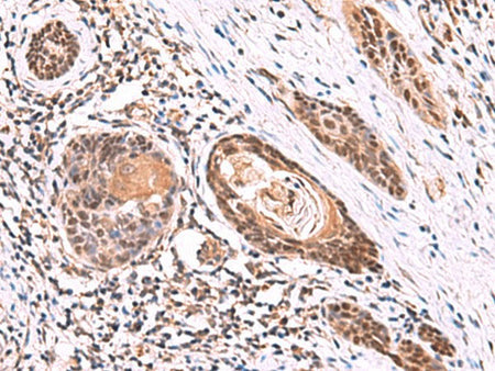 ITPR2 Polyclonal Antibody Reactivity Rat