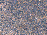 ITPR2 Polyclonal Antibody Reactivity Rat