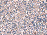 JAZF1 Polyclonal Antibody