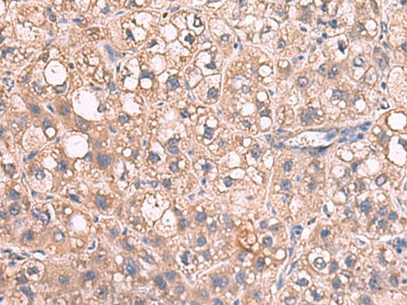 JAZF1 Polyclonal Antibody