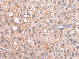 JAZF1 Polyclonal Antibody