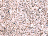 KDM7A Polyclonal Antibody Reactivity Mouse