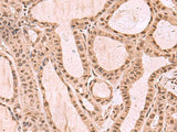 KDM7A Polyclonal Antibody Reactivity Mouse