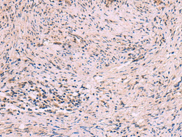 MBTPS2 Polyclonal Antibody