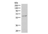 MBTPS2 Polyclonal Antibody