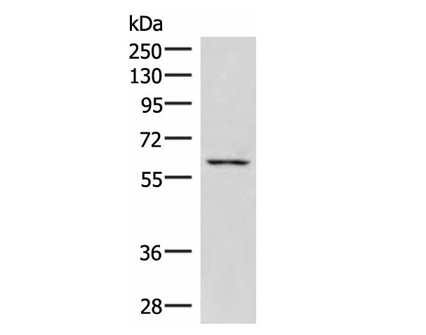 JRKL Polyclonal Antibody Reactivity Human