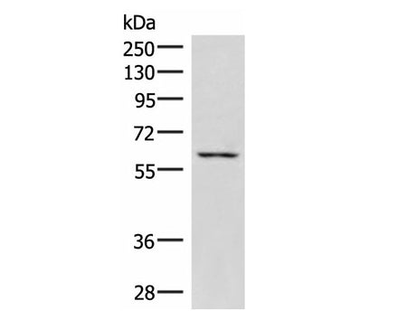 JRKL Polyclonal Antibody Reactivity Human