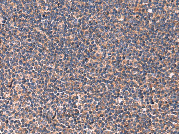 JAM3 Polyclonal Antibody Mouse