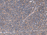JPH2 Polyclonal Antibody