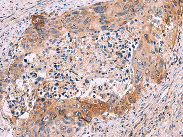 GRIK4 Polyclonal Antibody