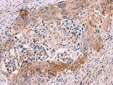GRIK4 Polyclonal Antibody