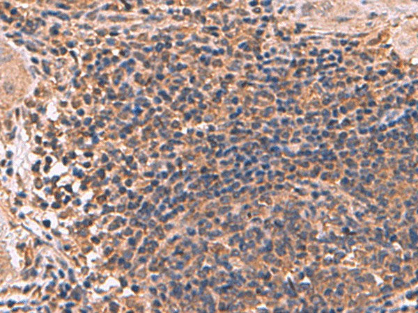 ZBTB33 Polyclonal Antibody Reactivity Human