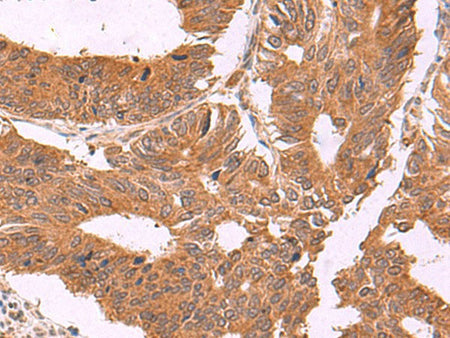 ZBTB33 Polyclonal Antibody Reactivity Human