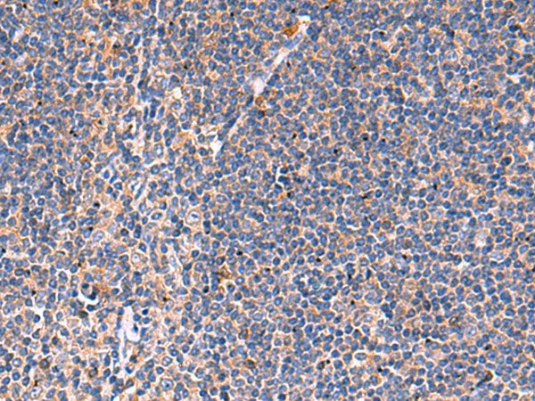 KLK9 Polyclonal Antibody Host Rabbit