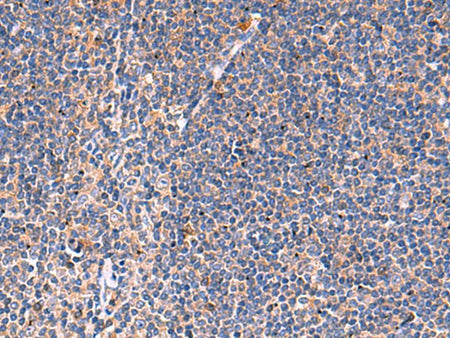 KLK9 Polyclonal Antibody Host Rabbit