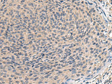 TNF Polyclonal Antibody Host Rabbit