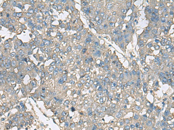 TNF Polyclonal Antibody Host Rabbit - Biomarkers - Elabscience Biotechnology - MSE Supplies