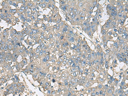 TNF Polyclonal Antibody Host Rabbit - Biomarkers - Elabscience Biotechnology - MSE Supplies