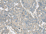 TNF Polyclonal Antibody Host Rabbit