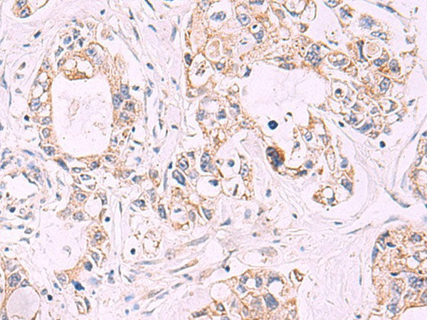 TNF Polyclonal Antibody Host Rabbit