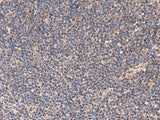 TNF Polyclonal Antibody Host Rabbit
