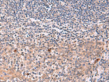 IFNA1/IFNA13 Polyclonal Antibody