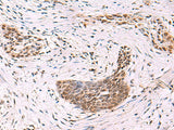 CREBBP Polyclonal Antibody Reactivity Rat