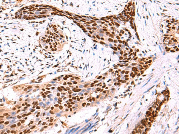 SOX2 Polyclonal Antibody Reactivity Human