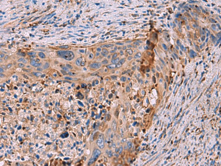 KBTBD11 Polyclonal Antibody Reactivity Mouse