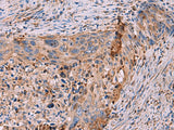 KBTBD11 Polyclonal Antibody Reactivity Mouse