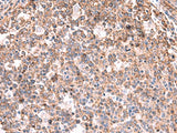 KBTBD11 Polyclonal Antibody Reactivity Mouse