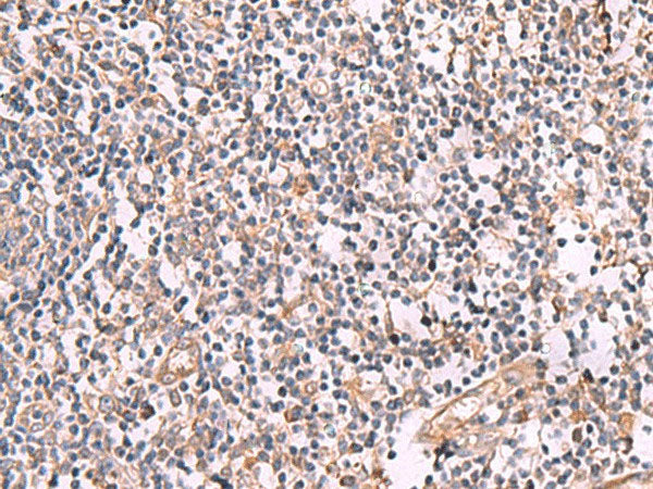 SLC12A5 Polyclonal Antibody Reactivity Rat