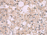 KCNIP1 Polyclonal Antibody Reactivity Rat